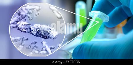 La mano del medico polmoni infetti concetto, tubercolosi presenza di infezione da micobatterio, tubercolosi batterica, cancro polmonare e malattia polmonare Foto Stock