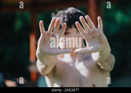 Giovane atleta che mostra le mani con i calli di intensi allenamenti sportivi all'aperto Foto Stock