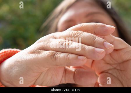 primo piano mani femminili 55 anni con danni cutanei secchi, bellezza e cura della pelle nella seconda emivita, trattamento dermatologico Foto Stock