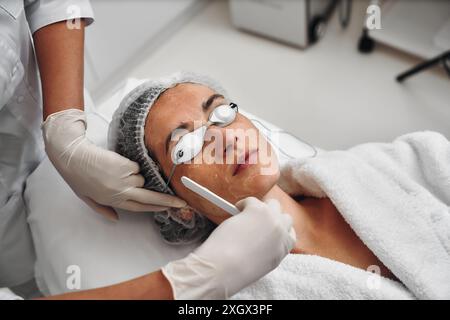 Una donna applica il gel al viso prima di una procedura laser. Foto Stock