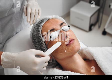 Una donna applica il gel al viso prima di una procedura laser. Foto Stock