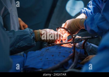 Primo piano di chirurghi che eseguono interventi di chirurgia cardiaca complessi in sala operatoria sterile Foto Stock