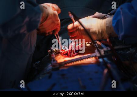 Un primo piano di chirurghi che eseguono interventi di chirurgia cardiaca complessi in una sala operatoria sterile Foto Stock