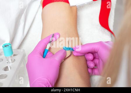 Il medico prende il sangue da una vena. Procedura PRP e concetto cosmetologico. Foto Stock