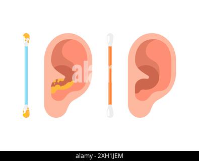 Orecchio umano e asticella. Bastoncino per la pulizia delle orecchie Illustrazione Vettoriale