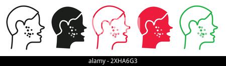 Acne uomo sull'icona del volto simbolo vettoriale o collezione di set di insegne in bianco e nero Illustrazione Vettoriale