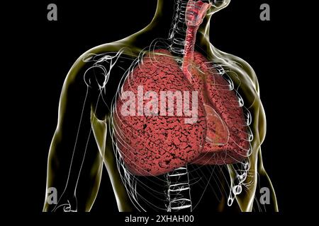 Illustrazione di polmoni influenzati dal fumo. Foto Stock