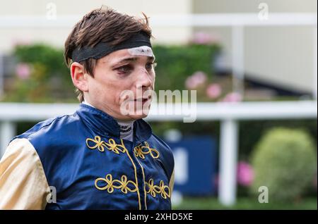 Ascot, Berkshire, Regno Unito, sabato 13 luglio 2024; il fantino Callum Shepherd è raffigurato dopo la gara ad Ascot, dopo aver assicurato un treble nella giornata, facendo coppia con Kodi Lion alla vittoria. Ha anche collaborato con Quddwah per vincere la gara principale, il gruppo 2 Anne Cowley Memorial Summer Mile Stakes e ha vinto anche a bordo della Surveyor. È raffigurato con lesioni al viso subite in una pesante caduta il giorno prima, sempre all'Ascot Racecourse. Crediti JTW equine Images / Alamy Live News Foto Stock