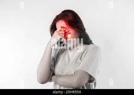 Una donna con il naso rosso e gli occhi rossi. Ha le mani sulla testa. Sinusite, frontite. Faccia femminile con infiammazione della mucosa di parana Foto Stock