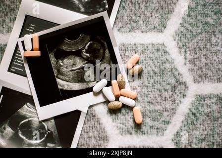 Foto del feto alla scansione ecografica e vitamine. Trattamento dell'infertilità. Inseminazione artificiale. Avere un bambino con la fecondazione in vitro. Risultati ecografici della gravidanza Foto Stock