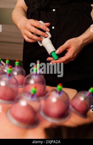 Dispositivo per massaggio sottovuoto nelle mani femminili. Il massaggiatore tiene in mano le attrezzature per il vuoto. Lattine per massaggio sottovuoto. Trattamenti ringiovanenti Foto Stock