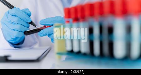 Mano del medico che tiene una fiala per il campione di sangue, prova il dispositivo medico, tenendo una fiala di campione di sangue davanti al modello di test. Donna che lavora con una sacca di sangue Foto Stock