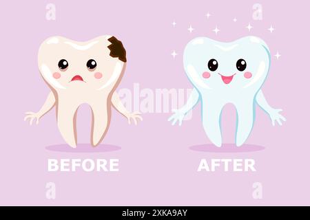 Un dente triste con carie e un dente sano e felice prima e dopo il trattamento. Concetto di trattamento dentale per odontoiatria pediatrica. Carino cartoni animati dentali Illustrazione Vettoriale