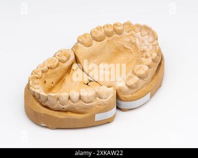 Modello odontoiatrico dopo un'impronta o un'impronta dentale. Tecnologia in odontoiatria come parte di un trattamento individuale per ottenere apparecchi. Fila superiore e inferiore. Foto Stock