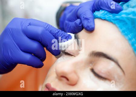 Paziente che riceve una procedura di idratazione mesoterapia sulle palpebre con microneedle presso l'ufficio dermatologo. Foto Stock