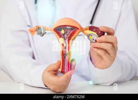 Medico ginecologo detiene un modello medico del sistema riproduttivo femminile nelle sue mani. Concetto di infertilità femminile, cancro, cisti ovarica. Foto Stock