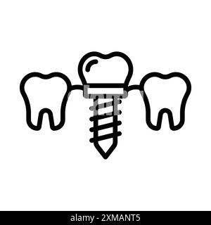 Icona degli impianti dentali, set di marchi con logo lineare, in bianco e nero per il Web Illustrazione Vettoriale