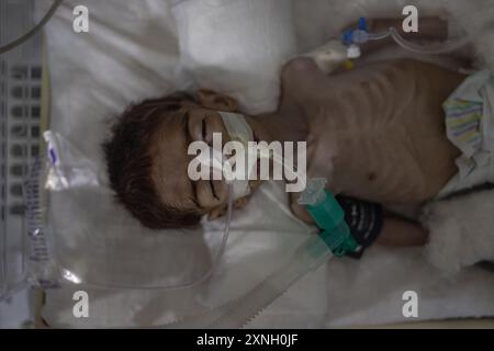 25 luglio 2024, Siria, Atimah: Un bambino affetto da grave malnutrizione e altre malattie nell'unità di terapia intensiva dell'ospedale HIHFAD nella città di Atimah. I residenti dei campi nel nord-ovest della Siria devono affrontare condizioni umanitarie disastrose a causa della mancanza di finanziamenti, che ha portato alla cessazione delle distribuzioni di panieri alimentari e a un aumento dei casi di malnutrizione nel 2024. Secondo un rapporto OCHA, il 50% delle strutture sanitarie smetterà di funzionare completamente o parzialmente a dicembre, e il numero di persone che soffrono di insicurezza alimentare ha raggiunto i 3,6 milioni. Foto: Anas Alkharboutli/dpa Foto Stock