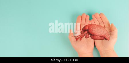 Organo del fegato infettato da virus, giornata mondiale dell'epatite, diagnosi di cancro, problema di salute della cirrosi, fegato grasso alcolico Foto Stock