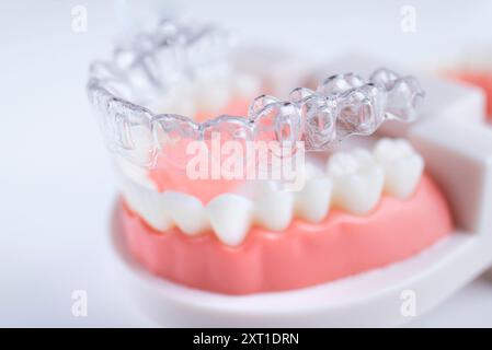 Cure dentistiche. Gli allineatori sono collocati su un modello artificiale di una mascella umana. Foto Stock