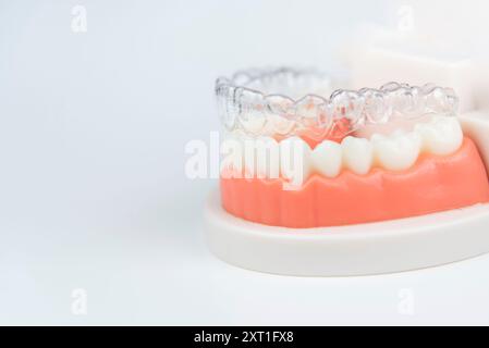 Cure dentistiche. Gli allineatori sono collocati su un modello artificiale di una mascella umana. Foto Stock