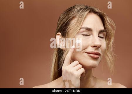 Una giovane donna con vitiligine applica la crema al viso su uno sfondo beige. Foto Stock