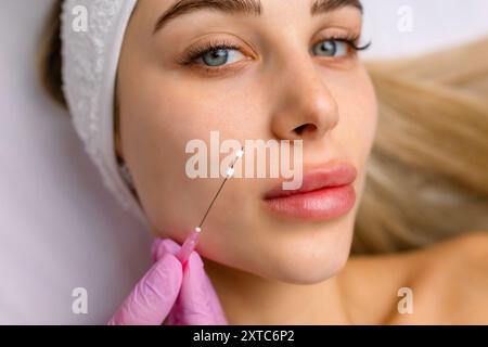 Face Lifting PDO suture Operation. Tecnica innovativa di New thread lift, cosmetologist preparandosi a fare la procedura per il cliente femminile, selezionare il Foto Stock