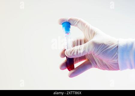 Analisi del sangue provette piene in mano del medico, su sfondo bianco, riprese in studio. Foto Stock