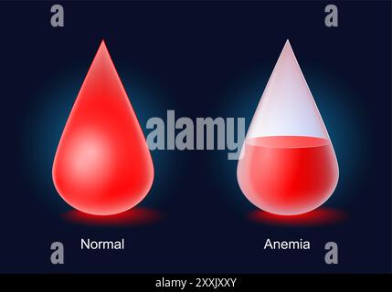 Anemia. Icone vettoriali sulle malattie del sangue. Forme gocce rosse con livello di sangue su sfondo scuro Illustrazione Vettoriale