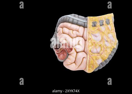 Intestino umano modello isolato su sfondo nero Foto Stock