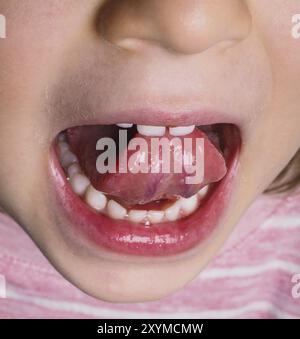 Bambina con camicia rosa che sporge la lingua all'indietro con molti denti bianchi Foto Stock