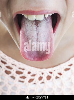 Giovane donna che sporge la placca bianca sulla lingua Foto Stock