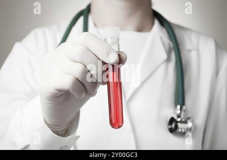 Medico tenendo una bottiglia di campione di sangue Foto Stock