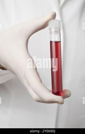 Medico tenendo una bottiglia di campione di sangue Foto Stock