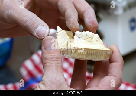 Le singole parti del modello dentato vengono assemblate Foto Stock