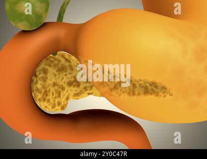 Immagine concettuale del pancreas umano e dello stomaco Foto Stock