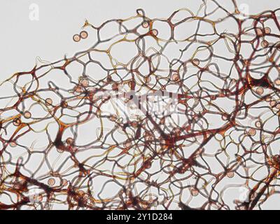 Spore, sporangia di Stemonitis Splendens melma muffa coltivata su legno in putrefazione. Osservabile in microscopio ottico con obiettivo 40x. Foto Stock