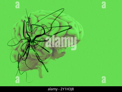 Illustrazione di un cervello umano con virus. Foto Stock