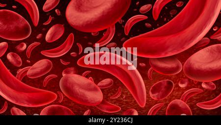 Anemia a cellule falciformi come una malattia del sangue rosso come un concetto di illustrazione medica di anatomia dell'emoglobina normale e anormale. Foto Stock