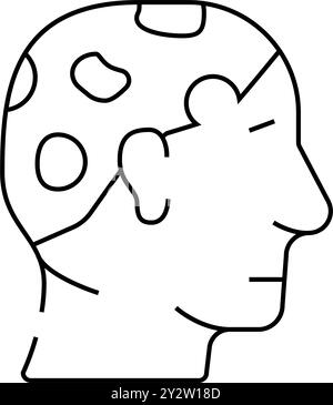 immagine vettoriale dell'icona della linea alopecia areata Illustrazione Vettoriale