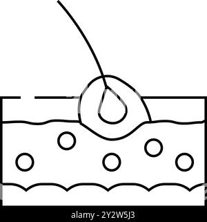 follicolite malattia della pelle problema linea icona vettore illustrazione Illustrazione Vettoriale