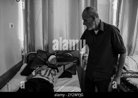 Beit Hanoun, Palestina. 2 giugno 2019. Al Baraa Fayeq Ahmed al-Kafarneh, 11 anni, riceve cure mediche in ospedale dopo che è stato ferito dai soldati israeliani il venerdì alle proteste al confine nella zona di Abu Safiya nel nord di Gaza. Il ragazzo ha perso l'occhio subito dopo essere stato colpito da un soldato israeliano con un proiettile di gomma e nonostante il trattamento ricevuto in un ospedale oftalmico a Gaza City. Secondo un rapporto pubblicato dall'organizzazione "Save the Children” alla fine di marzo scorso, almeno 49 bambini sono stati uccisi nella recinzione di frontiera di Gaza dall'inizio della grande marcia di ritorno Foto Stock