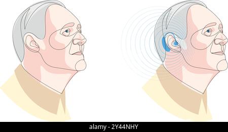Uomo anziano che indossa l'apparecchio acustico e sente bene. Concetto di trattamento Otolaringoiatrico. Una linea di dispositivi sanitari, tecnologia medica. Il vettore Illustrazione Vettoriale