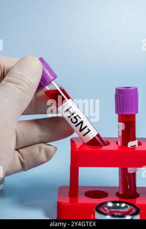 Provette per la raccolta di sangue H5N1 test risultati positivi,concetto di salute medica Foto Stock