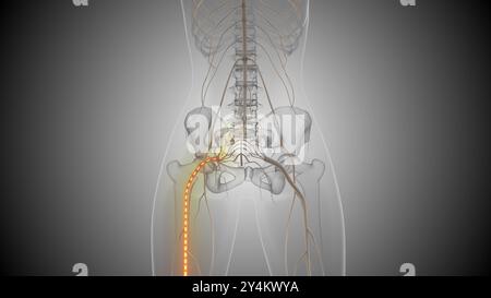 La sciatica provoca dolore alla schiena e alle gambe Foto Stock