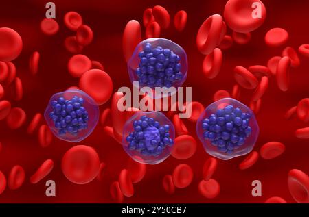 Linfoma diffuso a grandi cellule B (DLBCL) - Vista isometrica illustrazione 3d. Foto Stock