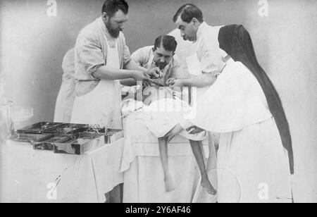 Legando le arterie dei gemelli Hindoo dopo l'operazione, la foto mostra il Dr. Eugene-Louis Doyen che esegue un intervento chirurgico per separare i gemelli radica e Doodica nel 1902., 1902, Glass negatives, 1 negativo: Vetro; 5 x 7 pollici. o più piccolo. Foto Stock