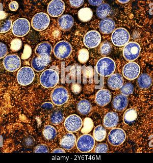 Vaiolo Monkeyx, TEM Foto Stock