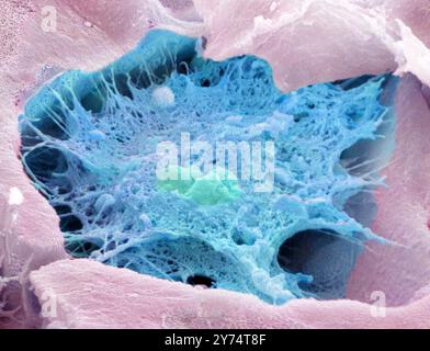 Cellule ossee degli osteociti. Micrografia elettronica a scansione colorata (SEM) di una cellula ossea osteocitica circondata da tessuto osseo. Questa cellula fratturata mostra un nucleo al centro. Gli osteociti sono osteoblasti (cellule che producono ossa) che sono rimasti intrappolati nelle cavità ossee (lacune, depressioni ossee). Producono e secernono la matrice organica dell'osso (osteoide). Non appena si forma l'osteoide, i sali di calcio si cristallizzano al suo interno per formare un osso duro e mineralizzato. Ingrandimento: x4000, quando stampato largo 10 centimetri. Foto Stock