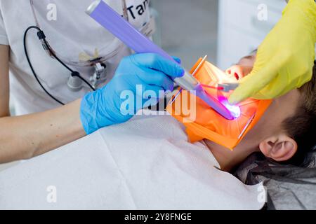 Trattamento della carie in una clinica odontoiatrica per bambini. Processo di installazione di un moderno riempimento fotopolimerico su un dente malato del bambino. Foto Stock